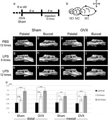 Differential Mechanism of Periodontitis Progression in Postmenopause